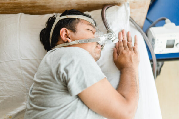 Obstructive Sleep Apnea