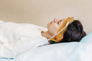 Sleep Study (Polysomnography)